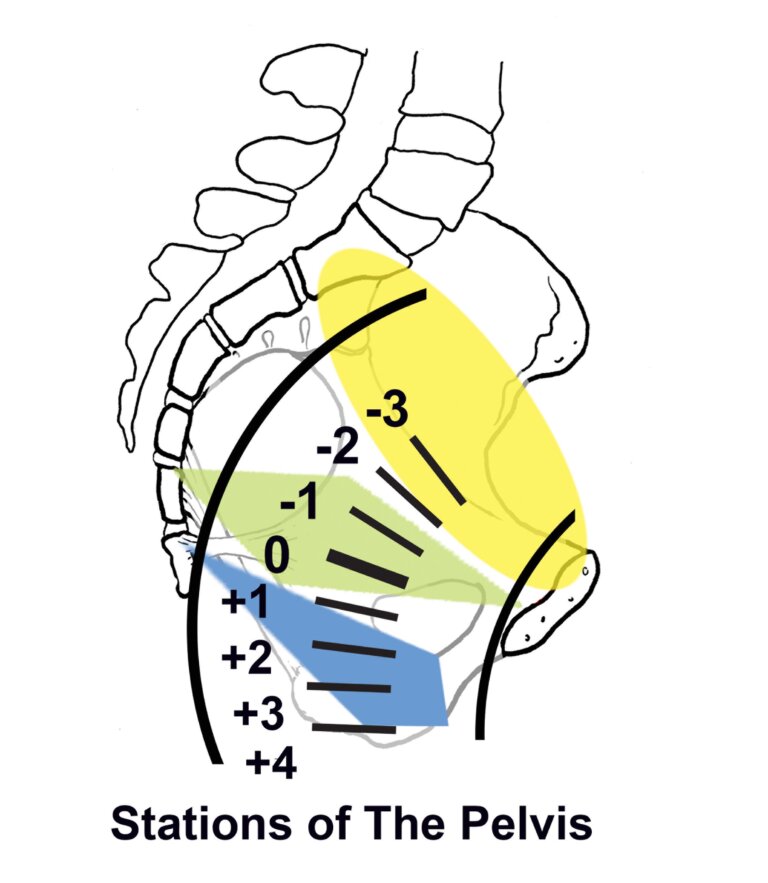 The Three Levels of the Pelvis and Maternal Positioning Spinning Babies