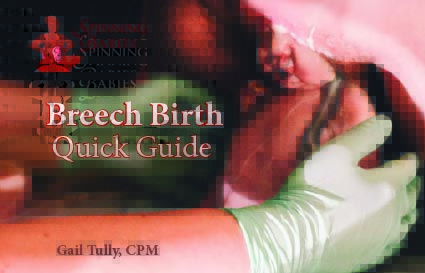 Breech Birth Quick Guide