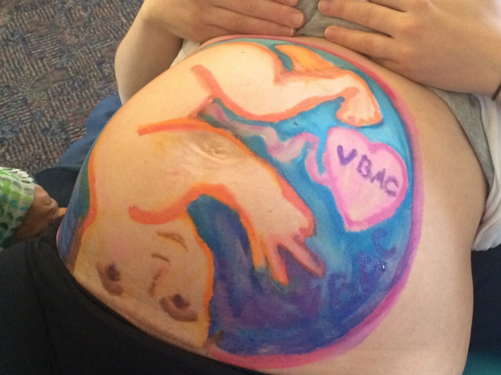 belly mapping VBAC