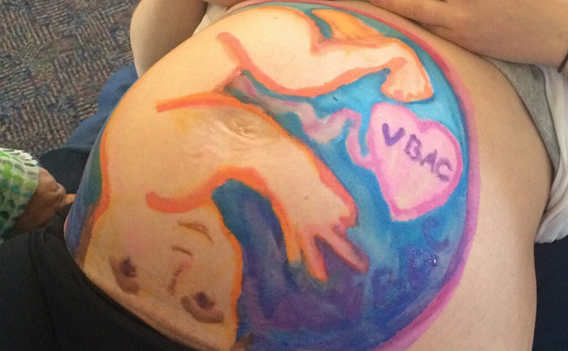 VBAC Belly Mapping
