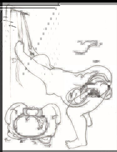 birth position