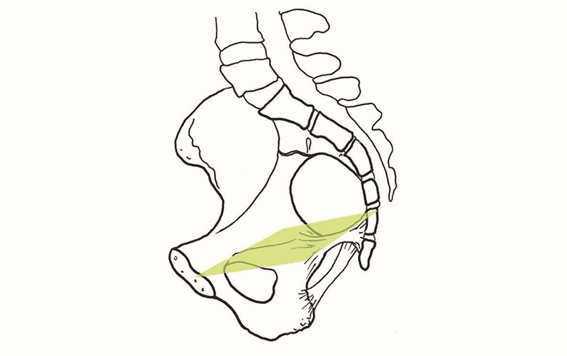 Midpelvis Solutions