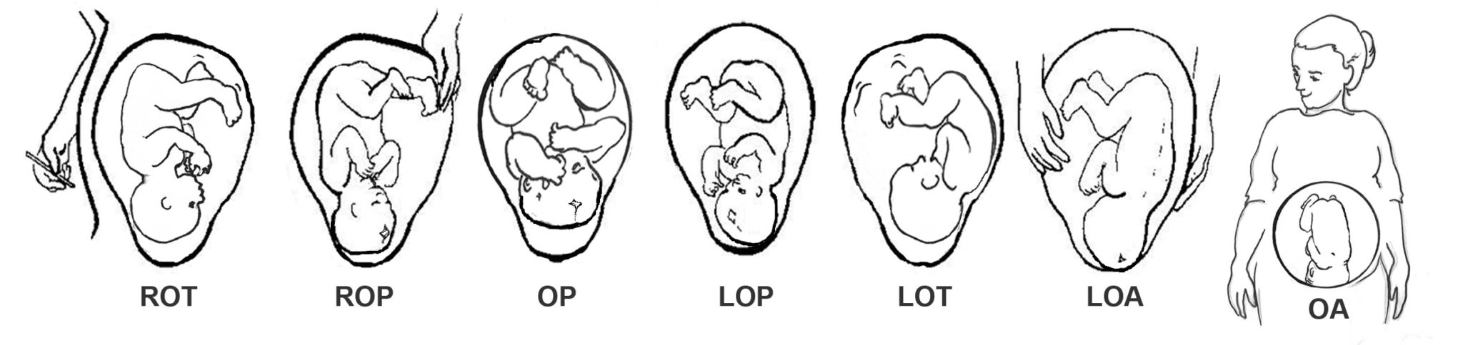 normal position of baby in pregnancy