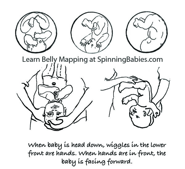 posterior presentation in pregnancy