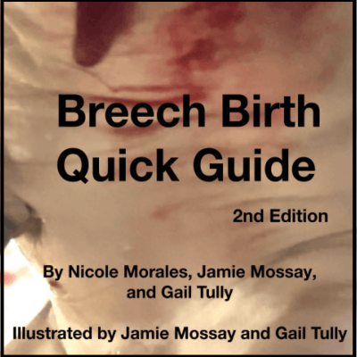 Breech Birth Quick Guide, 2nd Edition by Nicole Morales, Jamie Mossay and Gail Tully