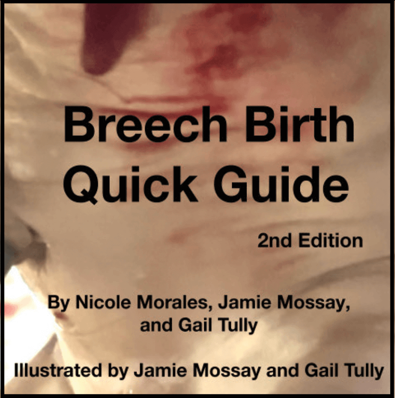 Breech Birth Quick Guide, 2nd Edition by Nicole Morales, Jamie Mossay and Gail Tully