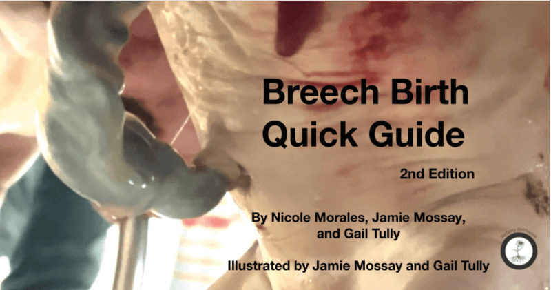 Breech Birth Quick Guide, 2nd Edition by Nicole Morales, Jamie Mossay and Gail Tully - Image 3