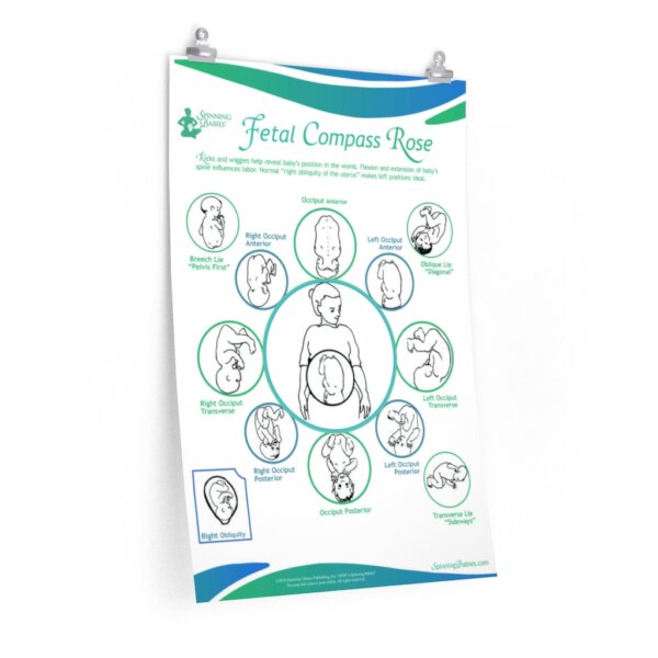 Spinning Babies® Badge Buddies Spinning Babies